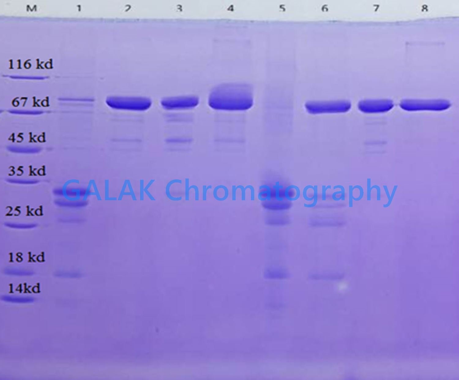 Lactoferrin purification Lactoferrin purification